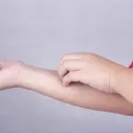 L'impetigine, cosa è, come si cura