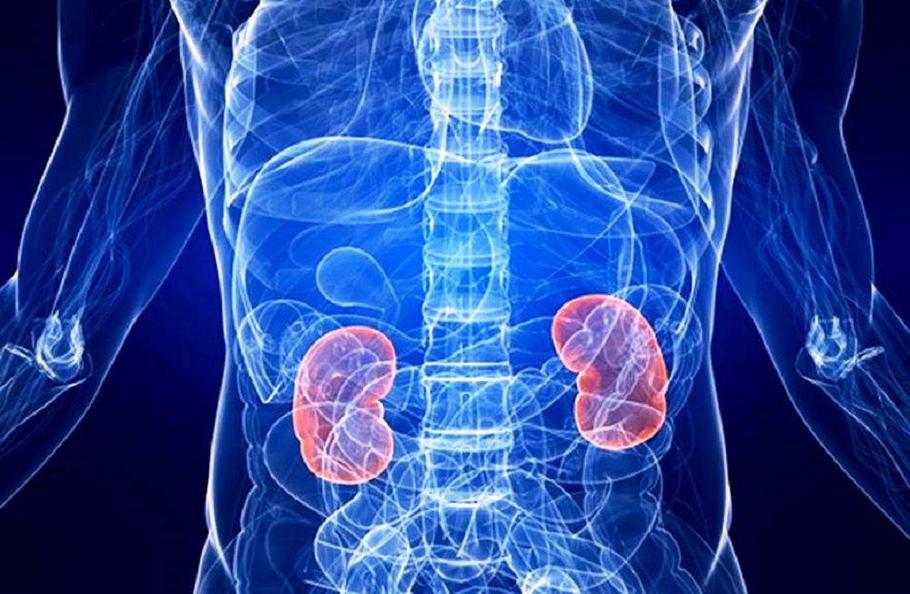 Malattie reni: alimentazione, dolore ai reni e calcoli renali